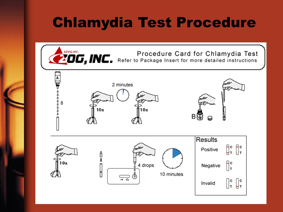 chlamydia-test